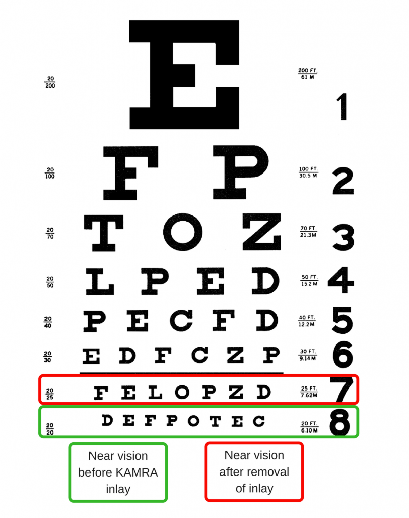 Professional Site. Reversed Snellen Eye Chart-20 Ft