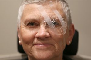 common questions concerns cataract