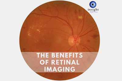 Cover image that says 'the benefits of retinal imaging'
