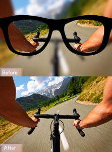 before and after laser eye surgery