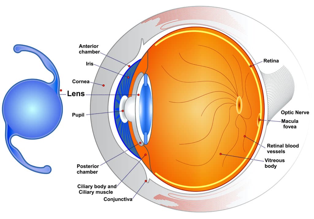 Image of eyeball highlighting where an intraocular lens sits within the eye following surgery