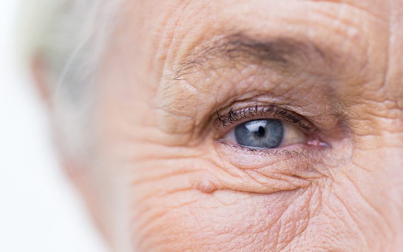 Cataract Eye Surgery Perth