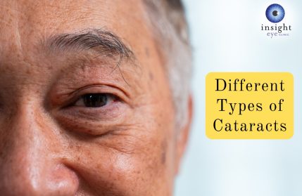 Image of an older man - different types of cataracts