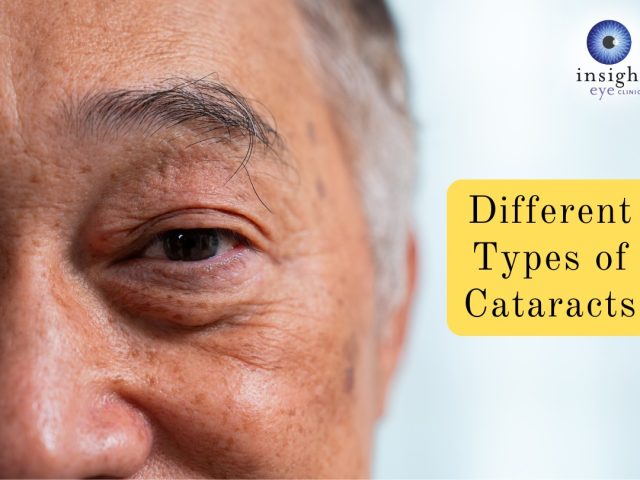 Different Types of Cataracts