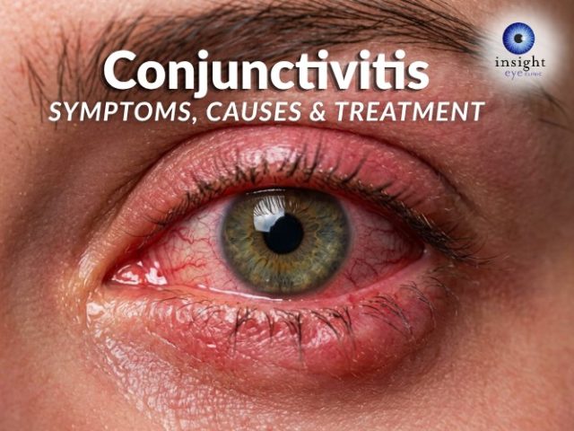 Conjunctivitis.  Symptoms, Causes and Treatment