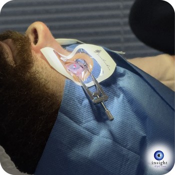 image of a man with a speculum holding his eye open